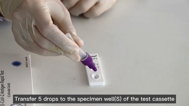 SARS CoV 2 Antigen Rapid Test Colloidal Gold－VSLFA 01 SOP-Era Biology смотреть онлайн