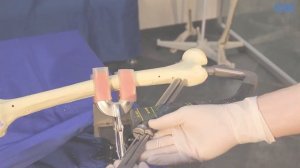 ОСТЕОМЕД®️ Шеечный и деротационный винт Установка. Проксимальный бедренный Y - штифт.