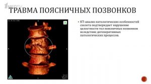 «Травмы у охотников каменного века. Что мы об этом знаем?». Гость: Бужилова А.П.