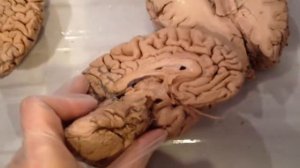 Анатомия человека  Мозг