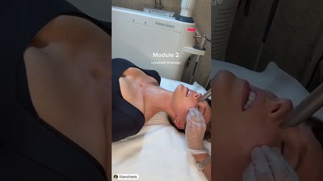 4D Fotona Laser Treatment #jawlinecontouring #skinrejuvenation #lipplumping #lasertreatment