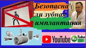 Имплант #23.Безопасна ли имплантация?#имплант#зубнойимплант#стоматолог
