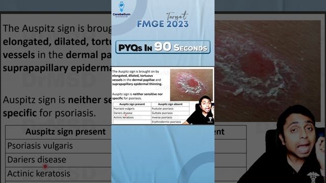 PYQ Revision in 90 seconds with Dr. Maddineni Srinivas | Cerebellum Academy