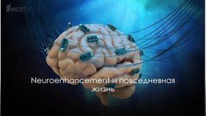 «Нейростимуляция в медицине и в повседневной жизни». Гость: Клеева Д.Ф.