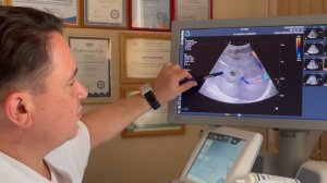 Обучение УЗИ. Ультразвуковое исследование пациентки с механической желтухой