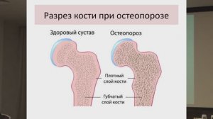 БАД "Флаванон-100" - новые исследования 2018 г. - д.б.н. Брусов О.С.