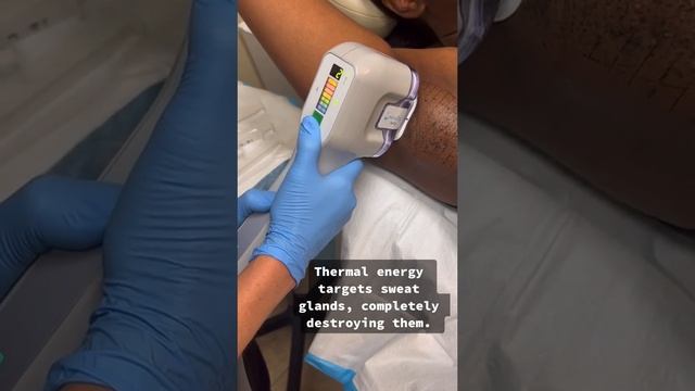 MiraDry смотреть онлайн