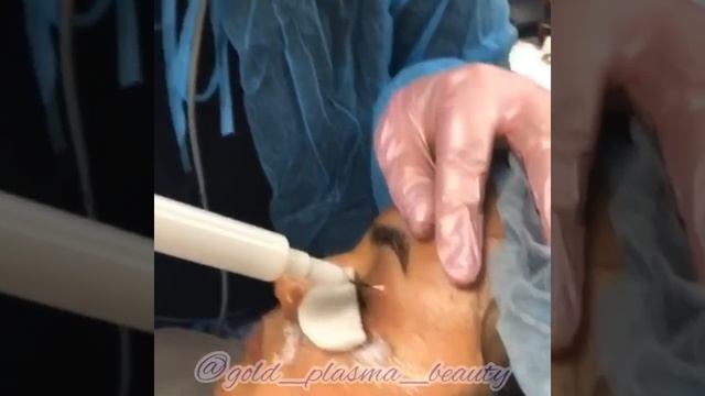 Омоложение кожи без радикальных методов