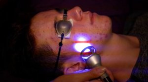 K-LASER Blue Derma - Laser Light Therapy Active Acne