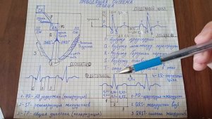 Проводящая система сердца. Зубцы, интервалы, сегменты ЭКГ.