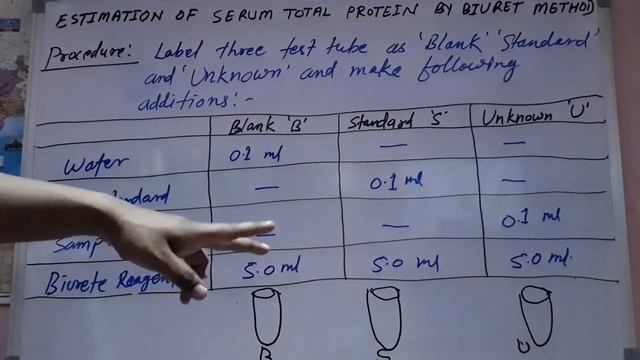 Total serum protein Test  Biochemistry test  Liver function test