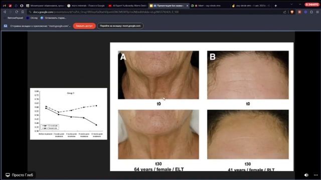 Влияние красного света на физиологию человека смотреть онлайн