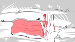 Мои Детские травмы ( история )