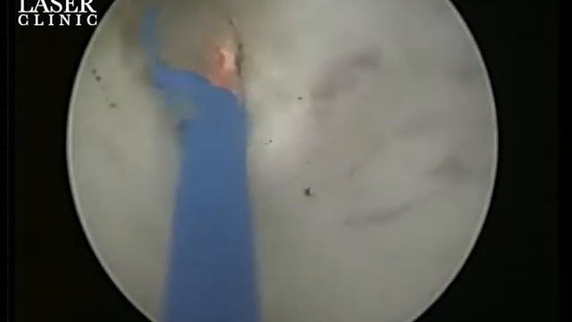 HOLEP FOR BHP смотреть онлайн