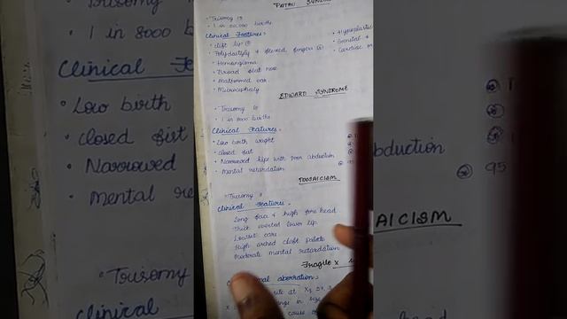 Edward syndrome in tamil #paediatrics #chromosomal смотреть онлайн