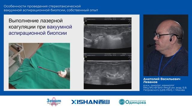 7. Леванов А.В. Особенности проведения стереотаксической ВАБ, собственный опыт