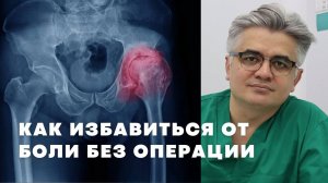 Можно ли обойтись без замены сустава? РЧД при коксартрозе и гонартрозе