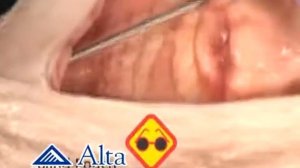 наслли молларни уруглантириш