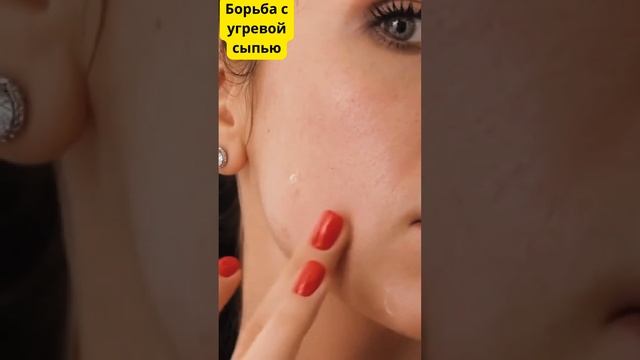 Что хорошо помогает от прыщей? Легко👉🏻 средства содержащие салициловую кислоту, работает 100%🎯✅!!
