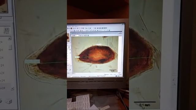 ПОД МИКРОСКОПОМ🐜 НАЕЗДНИК ТРИХОГРАММА, БИОМЕТОД И ПАРАЗИТЫ ЯИЦ.Trichogramma Under Microscope UKRAIN