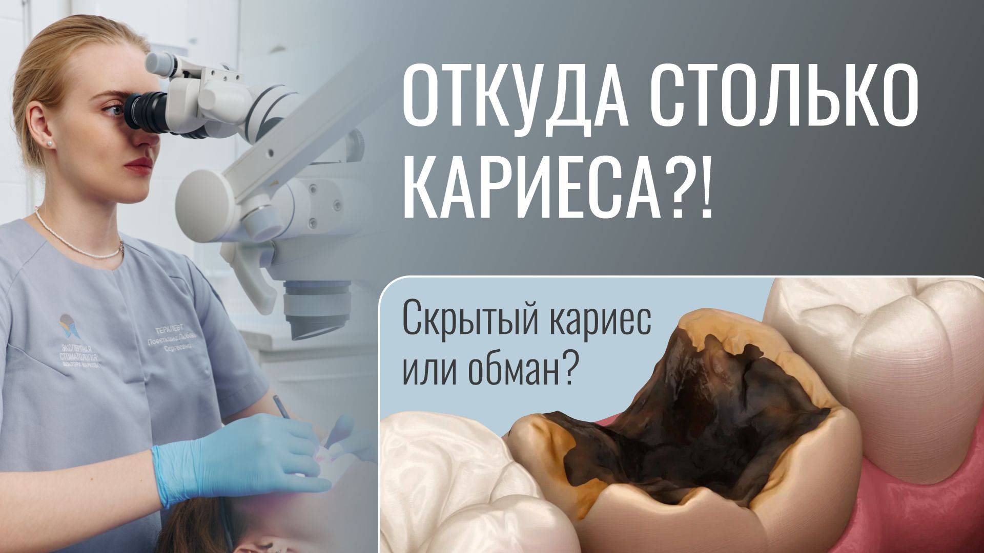 ОТКУДА СТОЛЬКО КАРИЕСА?! Скрытый кариес или обман?