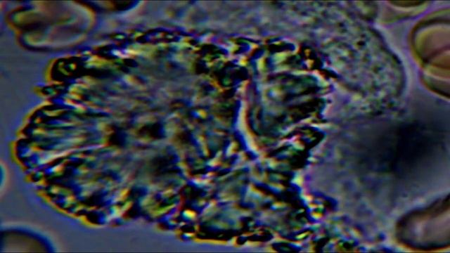 Тест крови 2