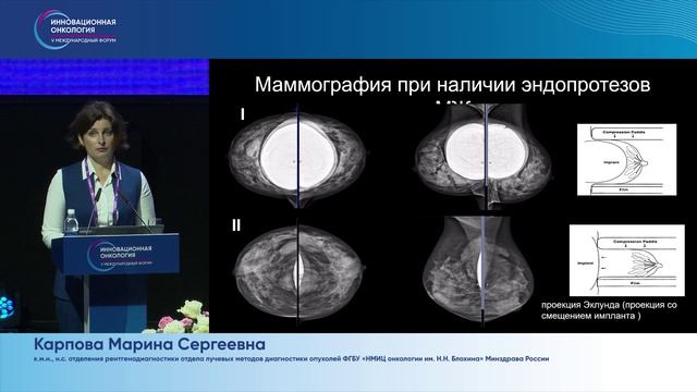 Скрининг и диагностика наследственного РМЖ. Когда начинать и что делать? Карпова М.С.