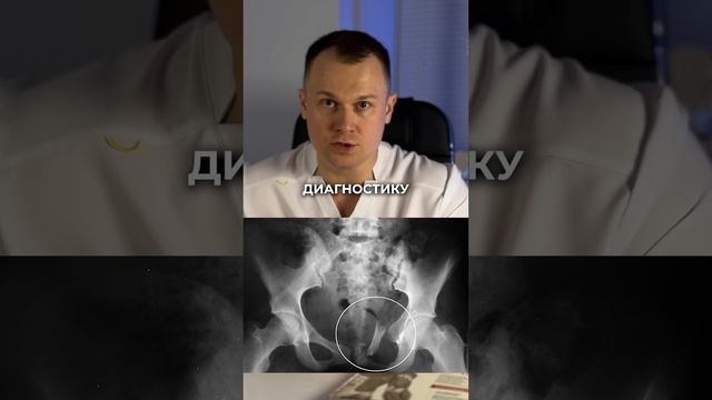 ПЕРВЫЕ ДЕЙСТВИЯ ПРИ БОЛИ В ПОЯСНИЦЕ 🤕