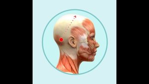 Апоневроз - когда  скальп прирастает  к черепу — сделано в Clipchamp