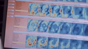 Многочастотный Электромпедансный Маммограф МЭМ