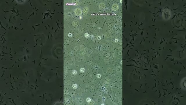 Lavender Oil vs Germs Under Microscope смотреть онлайн