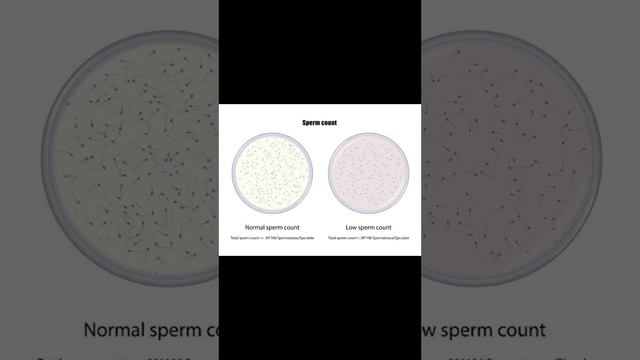 Normal Sperm Count