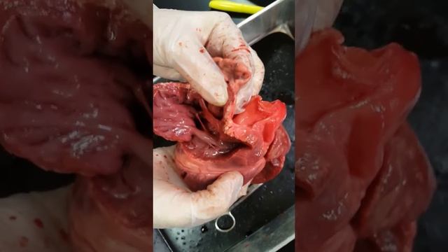 Parts of the heart смотреть онлайн