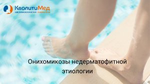 Вебинар "Онихомикозы недерматофитной этиологии: современный взгляд на диагностику"