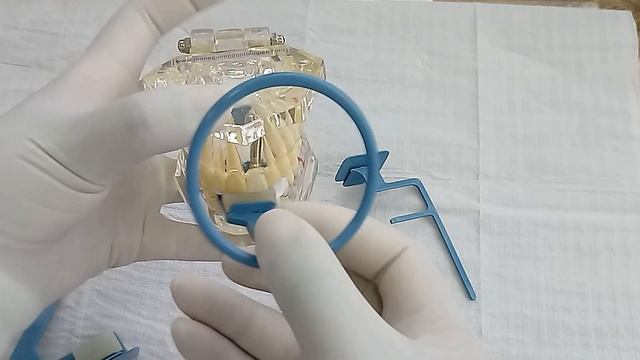 CONHEÇA OS POSICIONADORES PARA RX E SAIBA COMO USAR смотреть онлайн