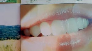 Пародонтоз, цинга. Решаем проблему.