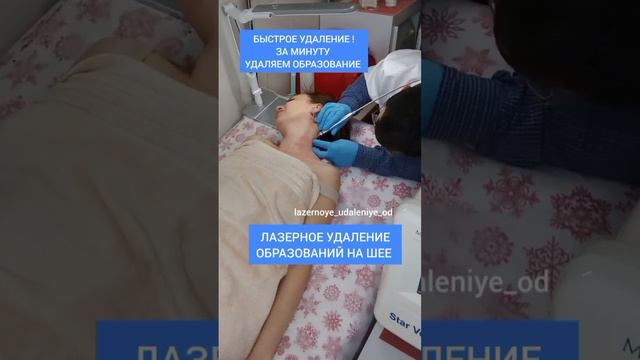 Лазерное удаление образований
