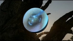 Ear Wax Removal Eps#292 || чистка ушной серы #292