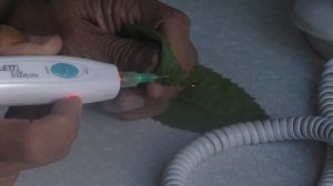 Медицина. Высокочастотный ионно плазменный коагулятор Копеца - ВИК 2019.