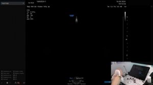 УЗИ аппарат Samsung V6