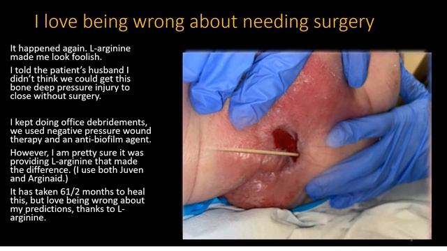 It happened again. L-arginine made me look foolish. смотреть онлайн