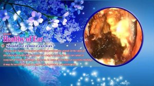 Cholesteatoma/Холестеатома #9