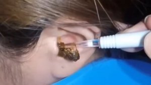 QULOQLARNI UY SHAROITIDA YUVISH.100 FOIZ ISHONCHLI