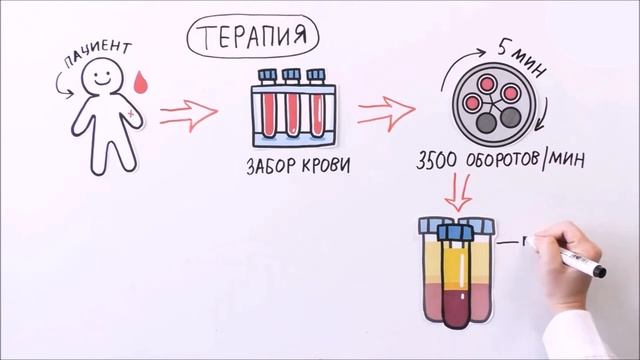 Плазмотерапия