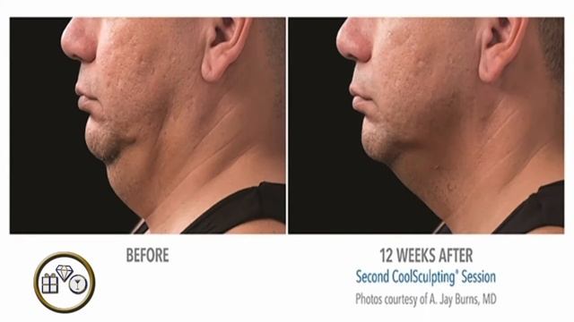 DR KARUN BALASETTY , Royal Caribbean Cruises , Symphony of the Seas, OneSpaWorld - MEDI-SPA AT SEA смотреть онлайн