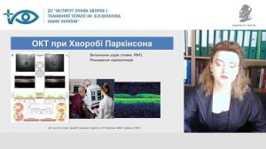 Зборовська О.В. Офтальмолог та нейродегенеративні захворювання - пильність та милосердя