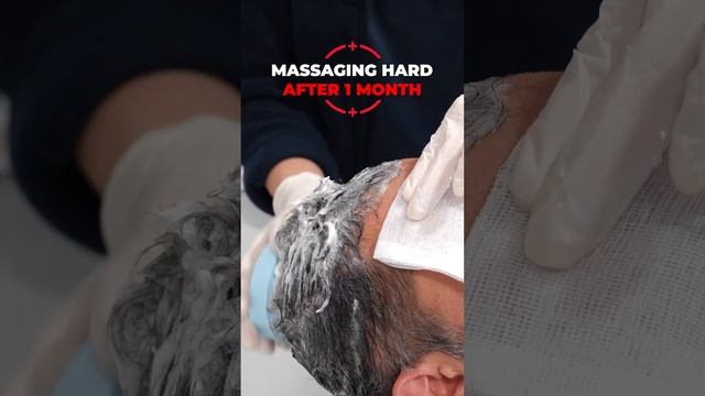 Post Hair Transplant Massage Tool | Dr. Cinik