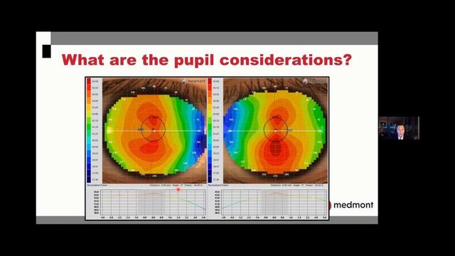 Webinar | medmont meridia imaging benefits to contact lens practice смотреть онлайн
