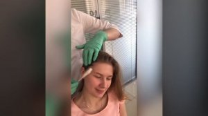 Криомассаж волосистой части головы