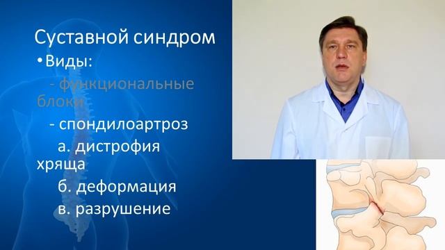 Спондилоартроз: причины и лечение